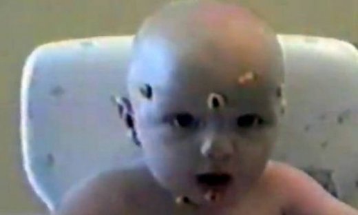 Βίντεο: Τι έπαθε αυτό το μωρό;