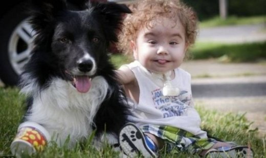 Τρισδιάστατη εκτύπωση ζωτικού οργάνου, έσωσε τη ζωή ενός μωρού!