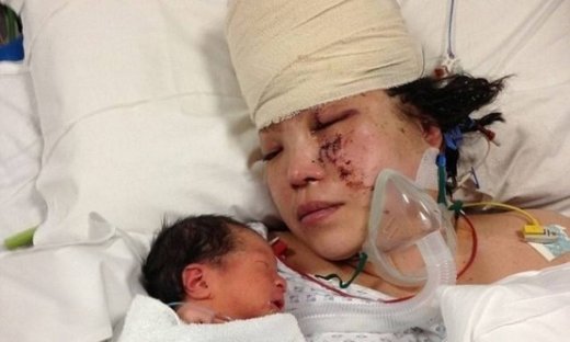 Ξύπνησε από κώμα και είδε για πρώτη φορά το μωρό που γέννησε! (Φωτογραφίες)