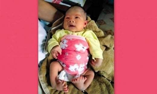 Μωρό στην Κίνα γεννήθηκε με 16 δάχτυλα στα πόδια!