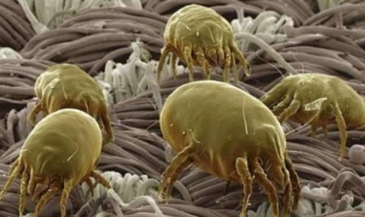 Ποιες είναι οι 13 μεγαλύτερες πηγές μικροβίων μέσα στο σπίτι σου...