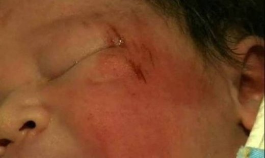 Γεννήθηκε στην άσφαλτο λίγο πριν ξεψυχήσει η μητέρα του (pic&vid)