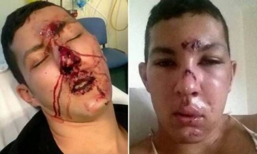 Έγινε μοντέλο αφού πρώτα τον είχαν κάνει… αγνώριστο! (photos)