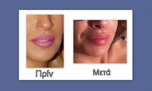 Ελένη Χατζίδου: Έλεος καλό μου. Άλλαξες στήθος… μύτη τώρα και χείλη; (Nassos blog)