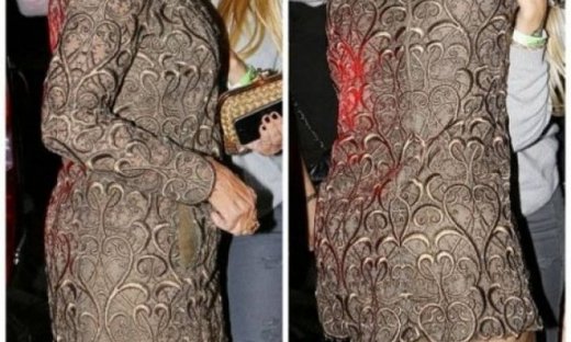 Τι το θες το μίνι; Δείτε την... «καθόλου κολακευτική εμφάνιση» της star!