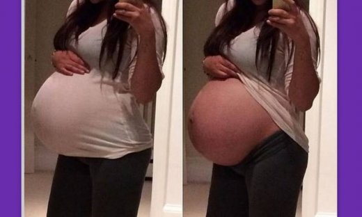 Γεννά και πόσταρε φωτογραφία της στο Instagram!