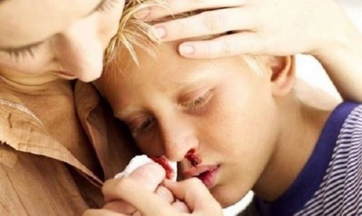 «Σπάει δόντι, χτυπάει το κεφάλι, τρέχει αίμα η μύτη»! Τι πρέπει να κάνετε σε περίπτωση που το παιδί σας τραυματιστεί