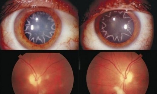 Οι πιο εντυπωσιακές ιατρικές φωτογραφίες του 2014