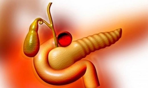 Παγκρεατίτιδα: Τι είναι, αίτια και συμπτώματα