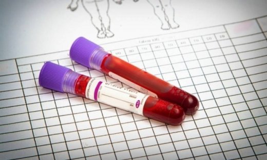 Χαμηλά λευκά αιμοσφαίρια: Ποιες είναι οι αιτίες