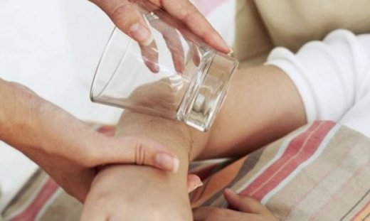 Βακτηριακή μηνιγγίτιδα ή Μηνιγγιτιδόκοκκός: Αίτια, συμπτώματα, θεραπεία