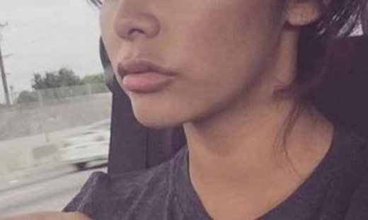 Η star έκανε αυξητική στα χείλη και ξεσήκωσε θύελλα αντιδράσεων!