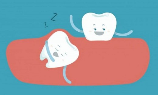 Έγκλειστος φρονιμίτης: Πώς γίνεται η εξαγωγή (βίντεο)