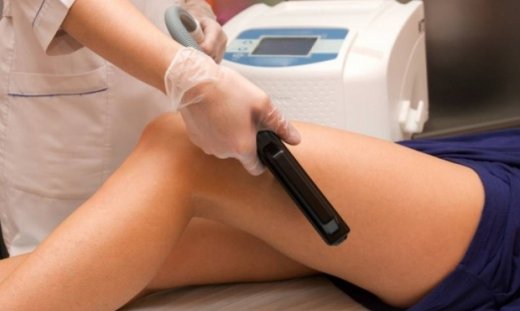 Αποτρίχωση λέιζερ: Δείτε πώς λειτουργεί σε αργή κίνηση! (βίντεο)