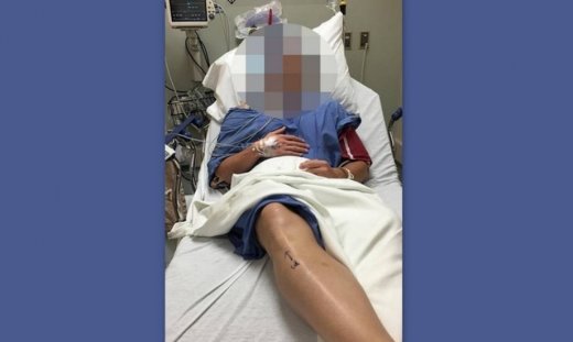 Υπεβλήθη σε χειρουργική επέμβαση και το αποκάλυψε ο ίδιος στο Instagram – Tι του συνέβη;