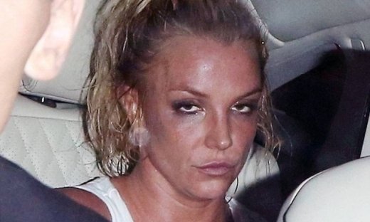 Britney εσύ; Τι σου συνέβη;