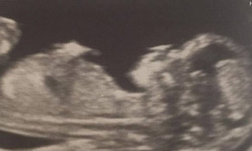 «Το μωρό μας είναι το καλύτερο δώρο που θα μπορούσαμε να κερδίσουμε ποτέ»