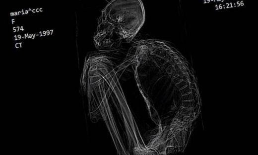 Περού: Βρέθηκε «εξωγήινη» μούμια με τρία δάκτυλα (vid)