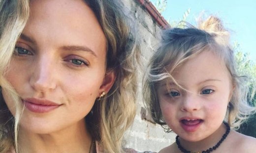 «Ανακάλυψα ότι ο γιος μου έχει Σύνδρομο Down όταν έγινε 3ων μηνών», το γνωστό μοντέλο εξομολογείται