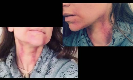 Η Ελληνίδα ηθοποιός, ο χωρισμός και οι εκδορές στον λαιμό. Τι συνέβη; (Nassos blog)