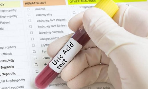 Ουρία: Τι είναι και πώς συνδέεται με τον κίνδυνο άνοιας