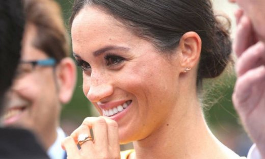 Αυτό το πολύ προσωπικό στοιχείο που άλλαξε η Meghan Markle μας τρόμαξε!