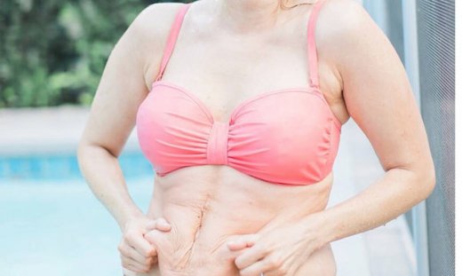 Στις 24 Μαΐου έγινε μαμά και τώρα τολμά να δείξει πώς μοιάζει το κορμί της (pics)