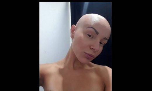 GNTM: Οι φωτό με μαγιό της παίκτριας που συγκίνησε τους κριτές θα σε συναρπάσουν (photos)