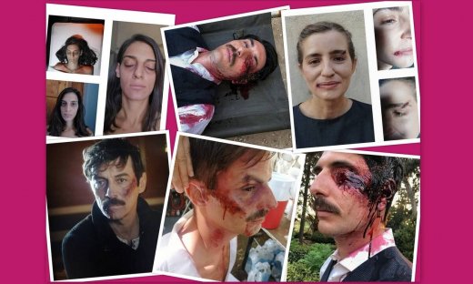 Άγριες Μέλισσες: Ο άνθρωπος πίσω από το συγκλονιστικό μακιγιάζ των ηθοποιών