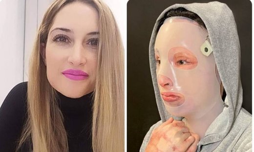 Επίθεση με βιτριόλι: Πέρασε ένας χρόνος και η Ιωάννα ξεσπά: «Μου στέρησε τη ζωή»