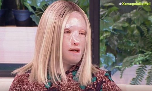 Ιωάννα Παλιοσπύρου: Η  αποκάλυψη για τη φωτογραφία χωρίς τη μάσκα και η συγκίνηση