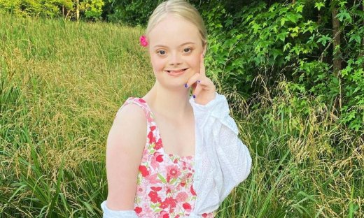 Ηθοποιός με σύνδρομο Down ονειρεύεται Oscar και αποδεικνύει ότι η επιτυχία είναι για όλους