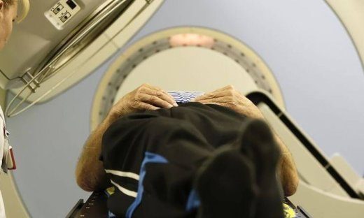 Η ενιαία μαγνητική τομογραφία διαγιγνώσκει τη μελέτη Αλτσχάιμερ πρώιμου και προχωρημένου σταδίου