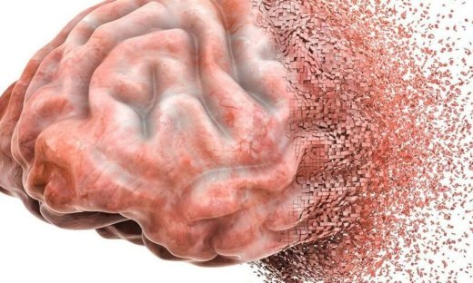 Ελπιδοφόρο το μέλλον για τη θεραπεία εγκεφαλικής βλάβης σύμφωνα με μελέτη