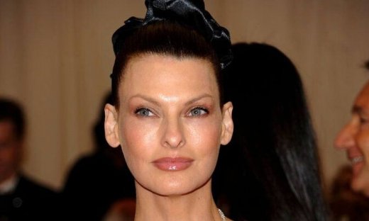 Linda Evangelista: Η πρώτη φωτογράφηση μετά την παραμόρφωση