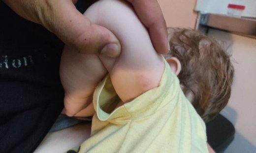 Δάγκωμα βρέφους από λυκόσκυλο:  «Δάγκωνε με μανία το παιδί μου» - Newsbomb.gr