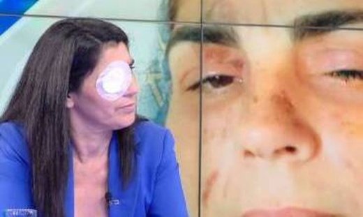 Επίθεση με οξύ στη Μεσσήνη: «Ούρλιαζα, καιγόμουν» περιγράφει η 49χρονη - Newsbomb.gr