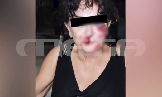 Αίγινα: Φωτογραφίες ντοκουμέντο από την άγρια επίθεση – Newsbomb.gr