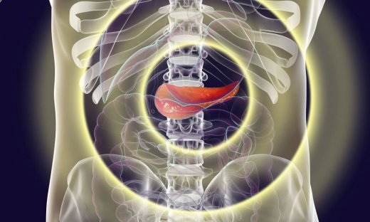 Καρκίνος στο πάγκρεας: Οι παράγοντες που οδηγούν στη μετάσταση