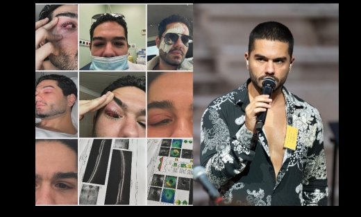 Χρήστος Μάστορας: Μας δείχνει το πρόσωπό του και τα σημάδια μετά το πρόβλημα υγείας που αντιμετώπισε