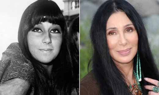 Σερ: Βγήκαν στη «φόρα» οι αισθητικές επεμβάσεις που έχει κάνει η 78χρονη σταρ - Και είναι πολλές!