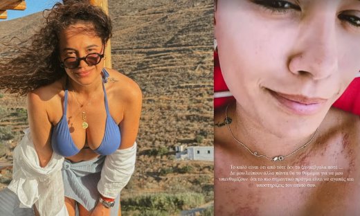 Πηνελόπη Πλάκα: Το δύσκολο καλοκαίρι, τα σημάδια στο κορμί της & το μάθημα ζωής!