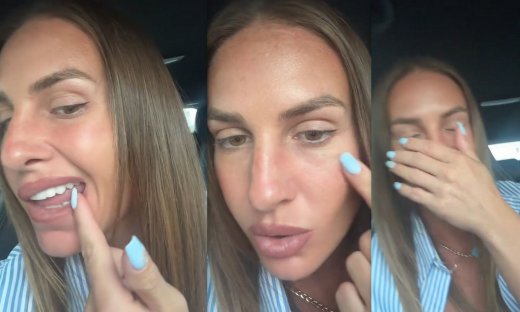 Ατύχημα για τη Δαλάκα: «Εκτός του ότι έχω σακατευτεί και έχω πρηστεί, έσπασα & δόντι»