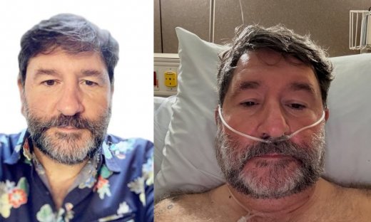 Συγκλονίζει ο Γιάννης Μπουροδήμος από το Masterchef - H επέμβαση αφαίρεσης όγκου & το μήνυμα