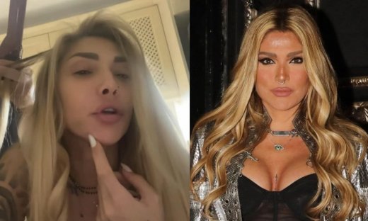 Αγγελική Ηλιάδη: Η μελανιά στο πρόσωπο, ο λόγος που την απέκτησε και η απάντηση στα αρνητικά σχόλια