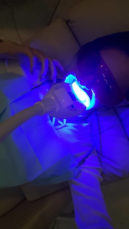 Μοντέλο του GNTM κάνει λεύκανση δοντιών και μας το δείχνει (Photo)