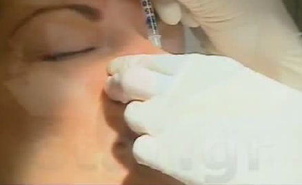 Ποια παρουσιάστρια έκανε μπότοξ μπροστά στην κάμερα; 