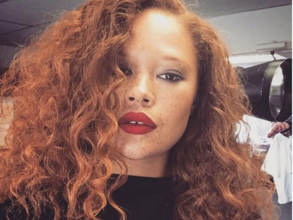 Σταμάτησε να είναι ανορεξικό μοντέλο, πήρε κιλά και… έγινε διάσημη