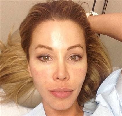 Πόσταρε το πρόσωπό της με αίμα στο Instagram (σοκαριστική φωτό)