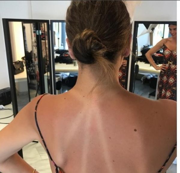 Σταματίνα Τσιμτσιλή: Το σημάδι από το μαγιό της (φωτό)